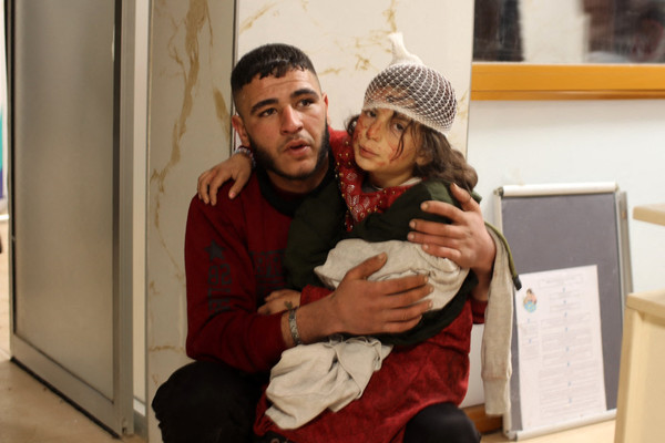 사진=튀르키예 강진 여파로 다친 시리아 소녀/AFP, 연합뉴스